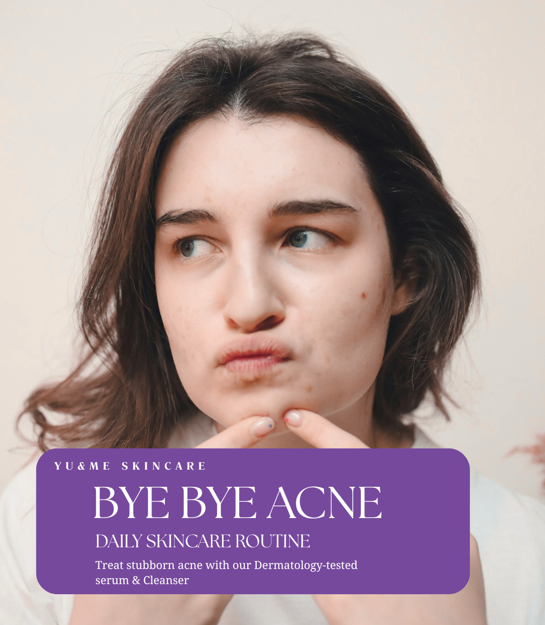 Medicated Skincare Routine that Helped me to Get Rid of Acne